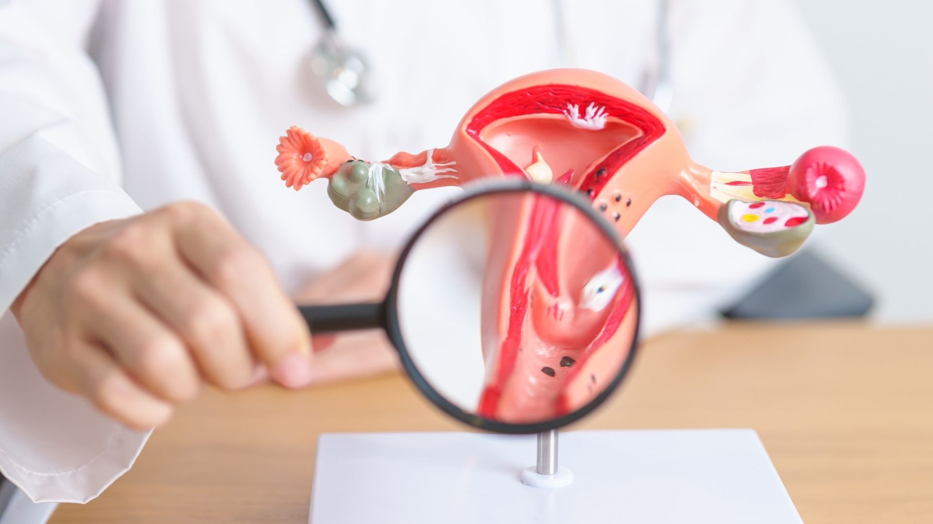 Dia Internacional da Luta contra a Endometriose