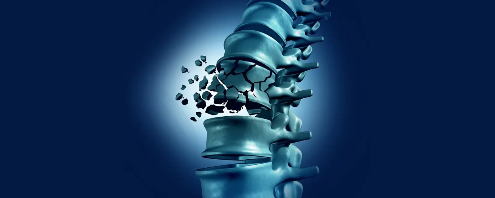 Dia Nacional da Osteoporose